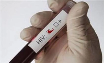 Aids Testi Nedir ve Nasıl Yapılır?